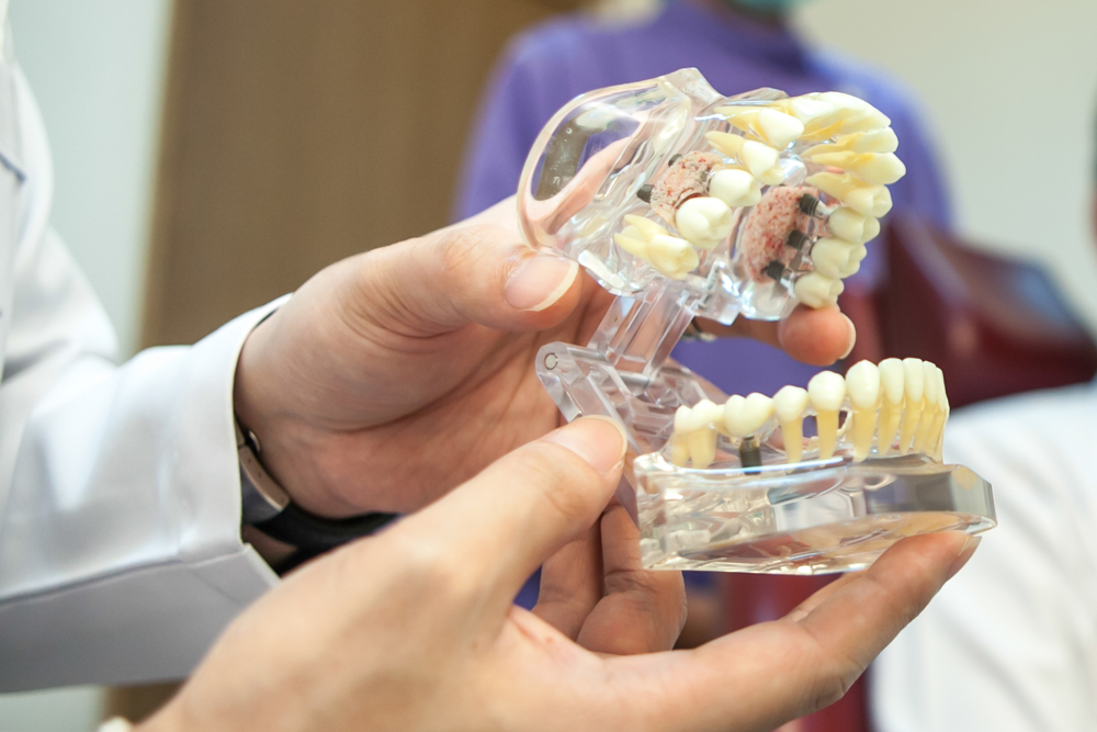 Hamilton Dental performs full mouth dental implants for patients in Hamilton, NJ