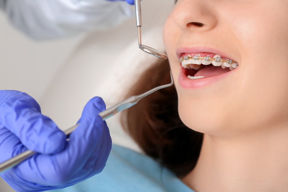 Young girl getting braces examined by an orthodontist