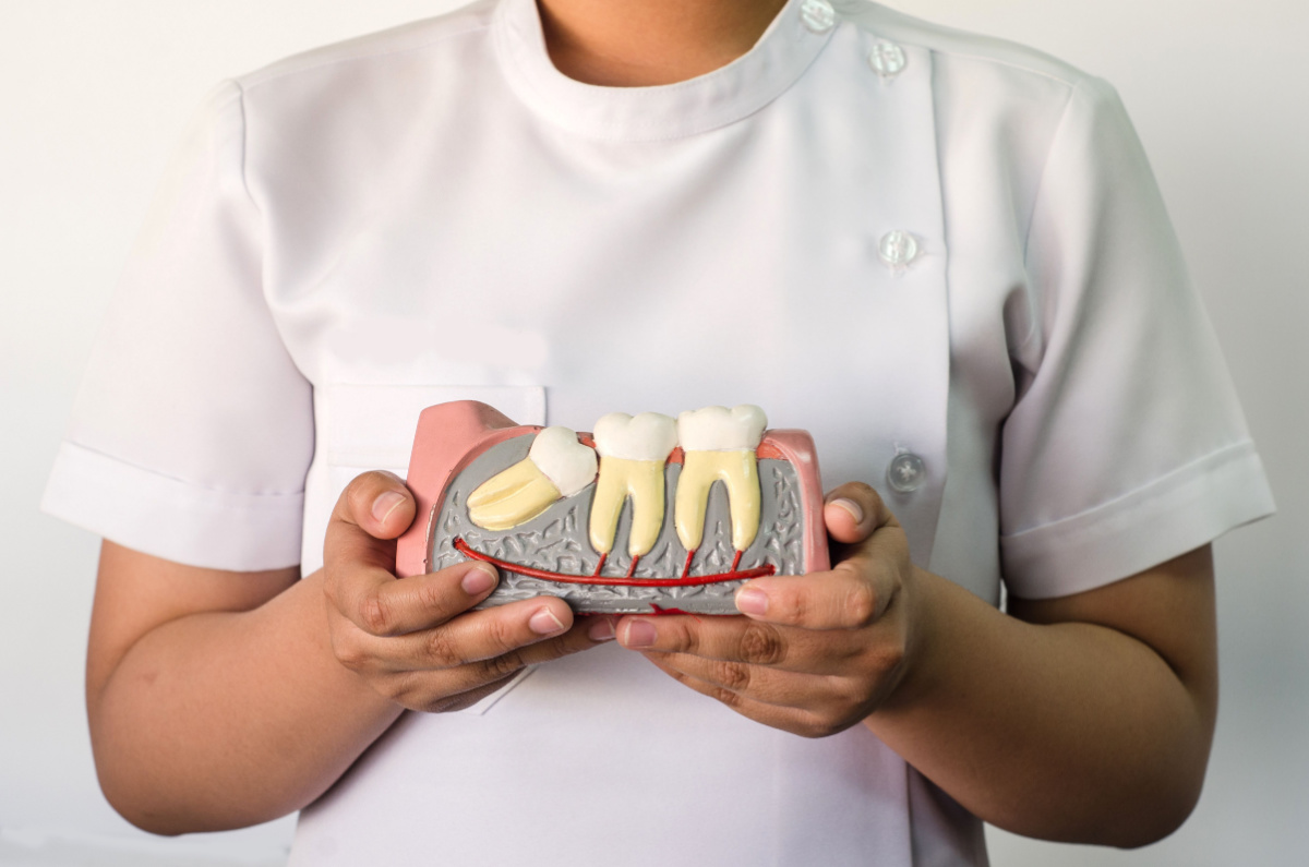 A person in a dentist outfit holding a model of three teeth in gums.
